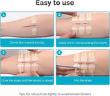 ZipSeal™ Closure Kit