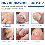 Fungal Nail Patches
