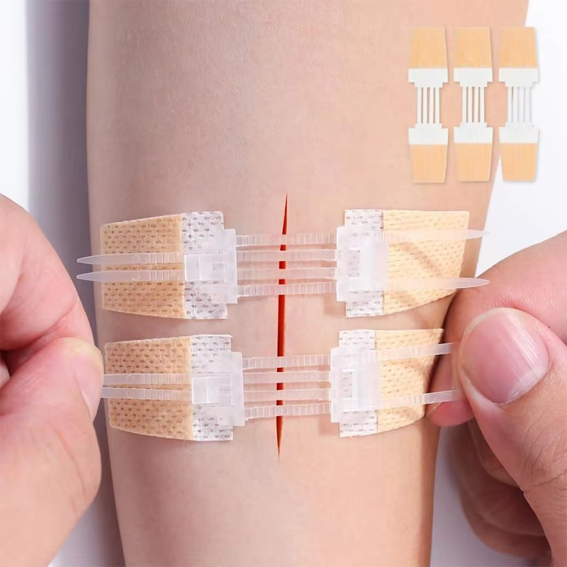 ZipSeal™ Closure Kit